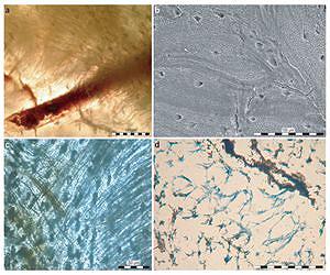 Bone Fibers