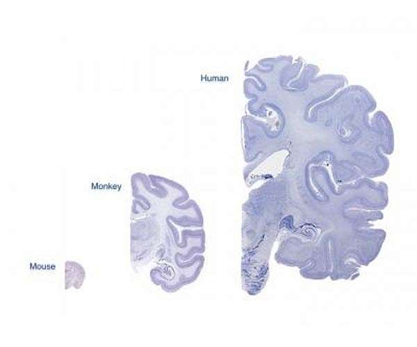 How to build a brain: discovery answers evolutionary mystery