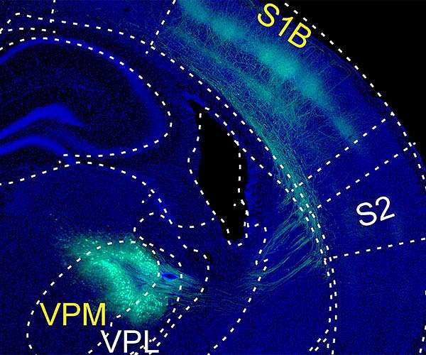 How touch dampens the brain's response to painful stimuli