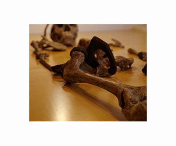 Archaeologists say skeleton shows earliest surgical amputation 31,000 years ago