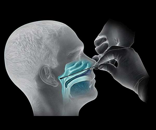 NATO to stockpile medical equipment for virus 2nd wave