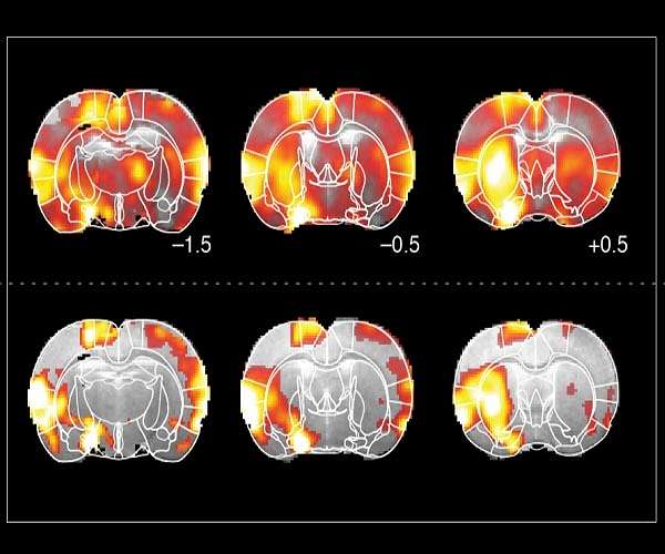 Scientists discover dopamine at the heart of desire