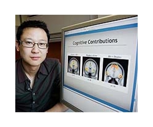 Justice In The Brain: Equity And Efficiency Are Encoded Differently