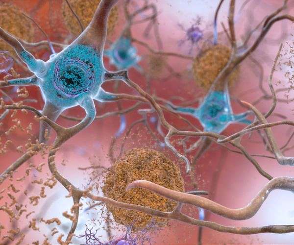 Smoking shrinks brain, says study linking cigarettes to Alzheimer's, dementia