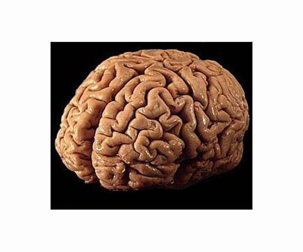 Tackling risk factors could stop or slow 4 in 10 dementia cases: study