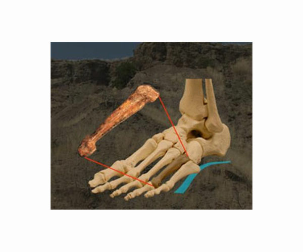 Long-overlooked arch is key to fuction, evolution of human foot