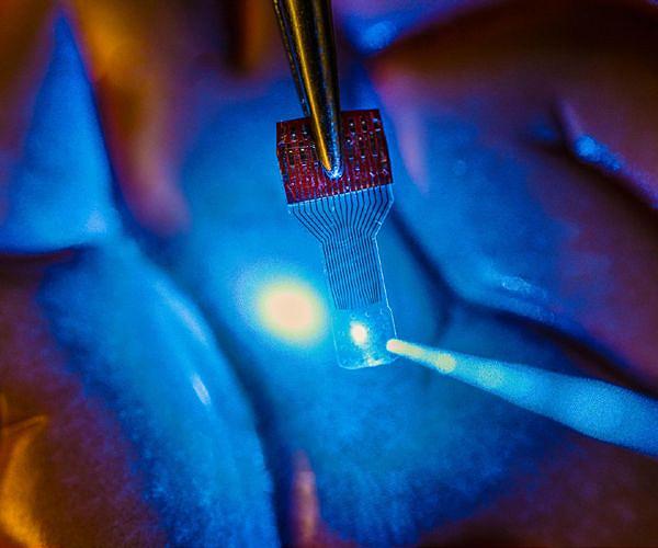 From 'magical' to 'rip it out': different brain implant experiences