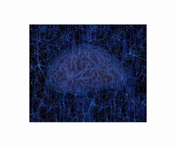 Does the human brain resemble the Universe