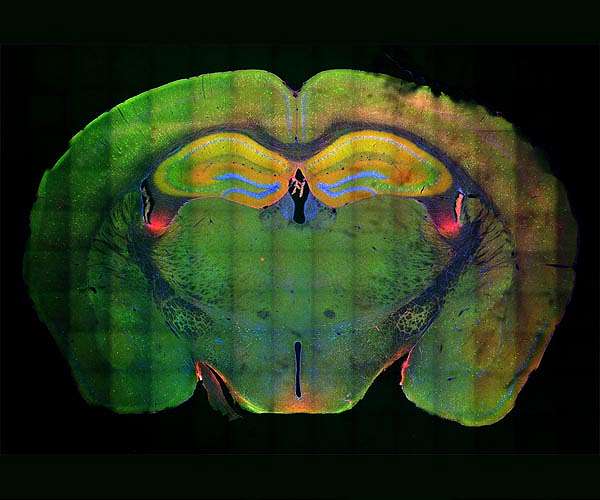 New microscopy technology helps scientists peer deeper into brain