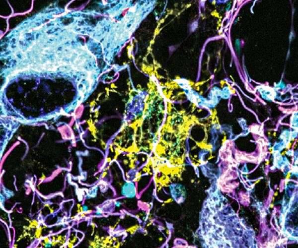 How cognition changes before dementia hits