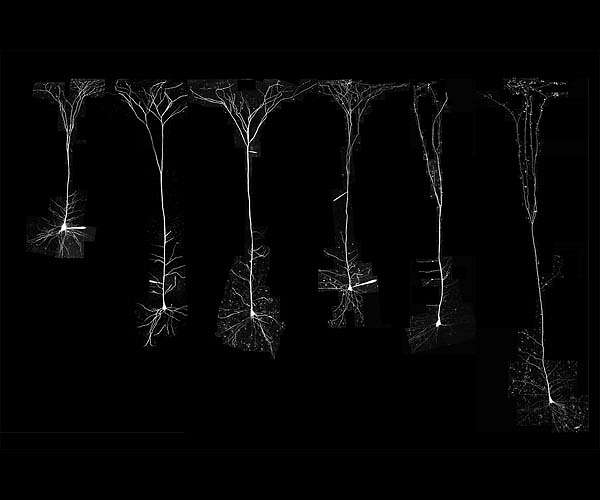 Study finds a striking difference between neurons of humans and other mammals