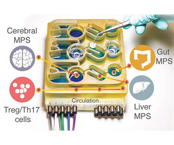 Our gut-brain connection