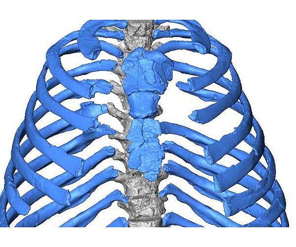 New virtual reconstruction of a Neanderthal thorax suggests another breathing mechanism