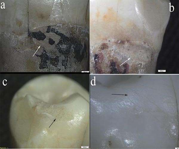 Neanderthals had the teeth to eat hard plants