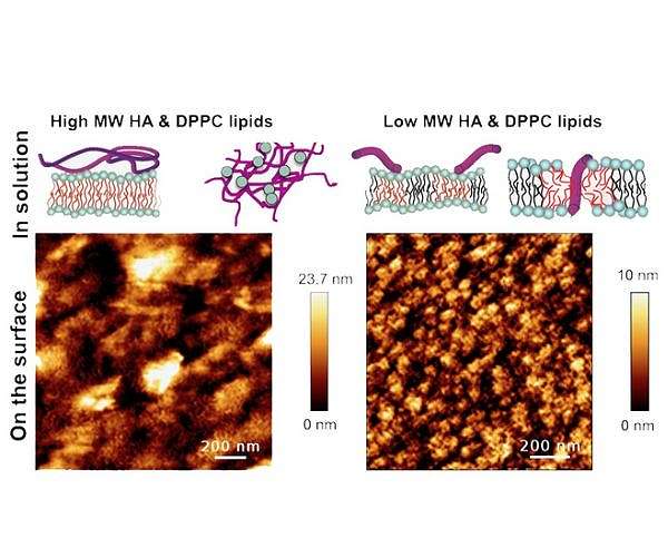 Composition of joint lubricant potential culprit behind osteoarthritis