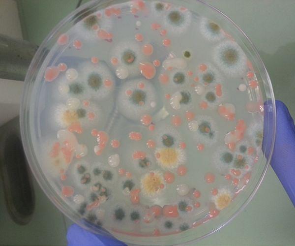 Bacteria Likely to Soon Infect ISS Crew Found to Be Antibiotic-Resistant