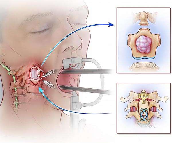 Scientists identify signals of fading consciousness during anesthesia, sleep