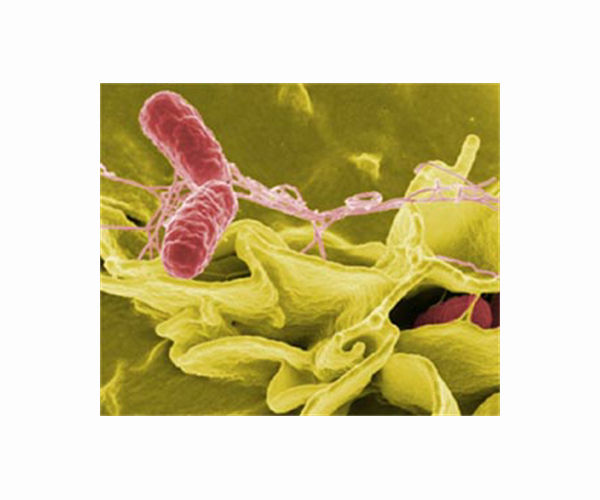 Study: Medieval British friars had more intestinal worms than general population