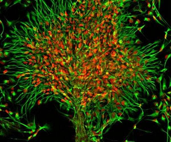 Uncovering the evolution of the brain