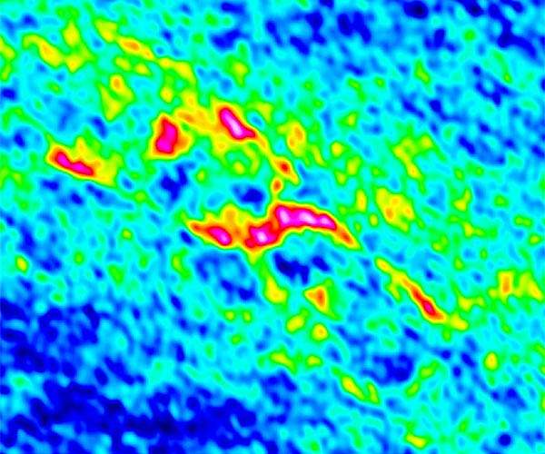 Little star sheds light on young planets