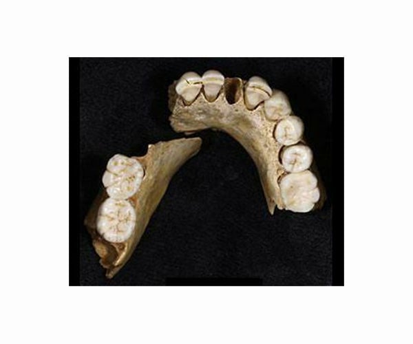 4,000-year-old teeth record the earliest traces of people chewing psychoactive betel nuts