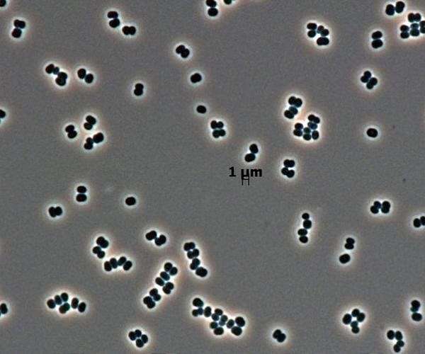 The bacteria that wont wake up found in spacecraft cleanrooms