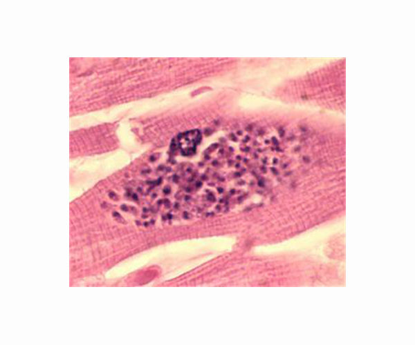 Salmon parasite is world's first non-oxygen breathing animal