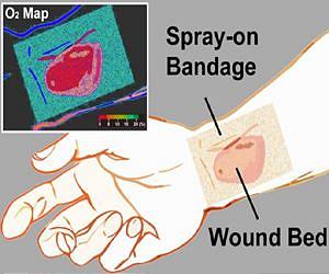 'Smart' bandage emits phosphorescent glow for healing below