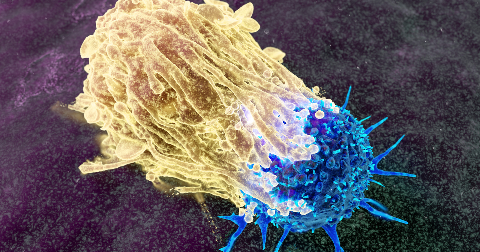 A molecule called MHC I was understood for decades as the thing that lets the immune system recognize cancer, until researchers found the immune system attacks hardest exactly when cancer switches it off