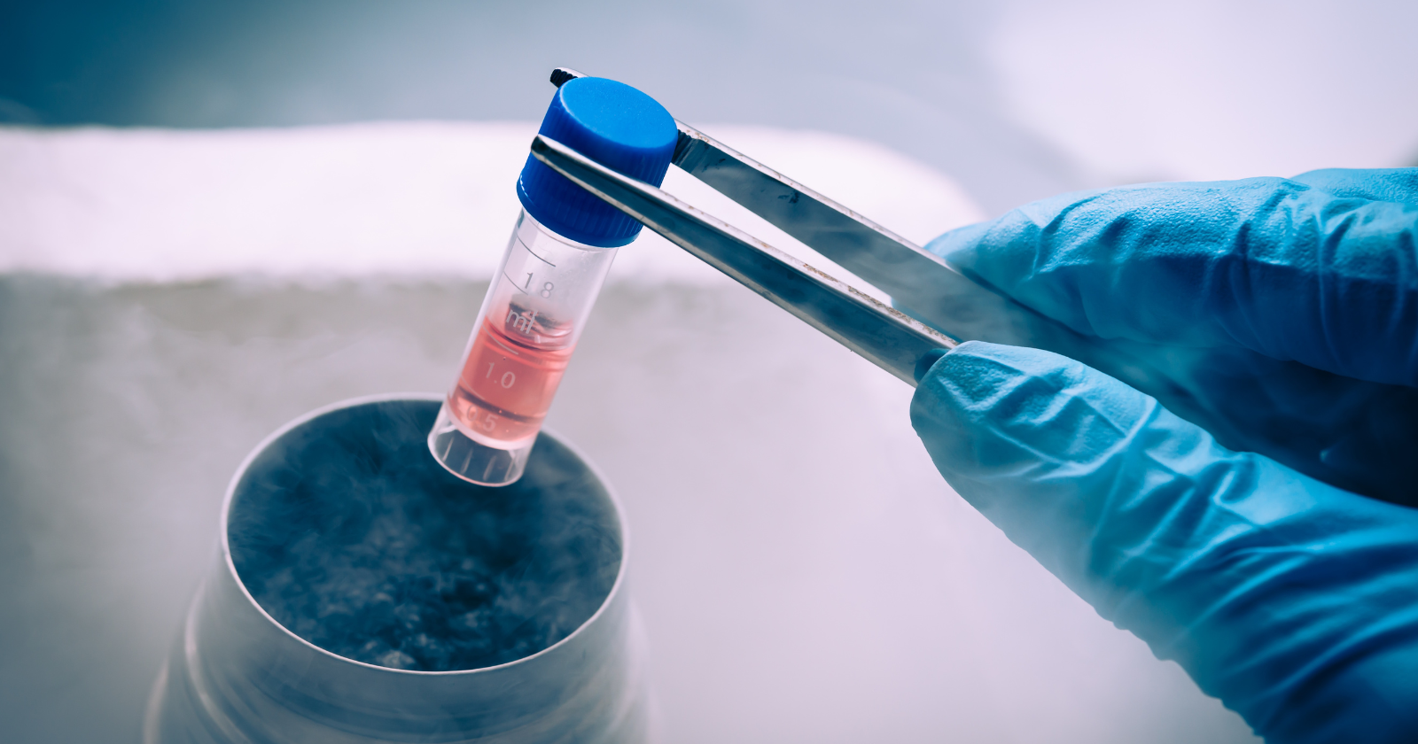 In October 2024, a team of Chinese researchers at Peking University reported that a 25-year-old woman who had lived with Type 1 diabetes since childhood stopped needing insulin injections within 75 days of receiving an experimental stem cell transplant generated from her own fat cells
