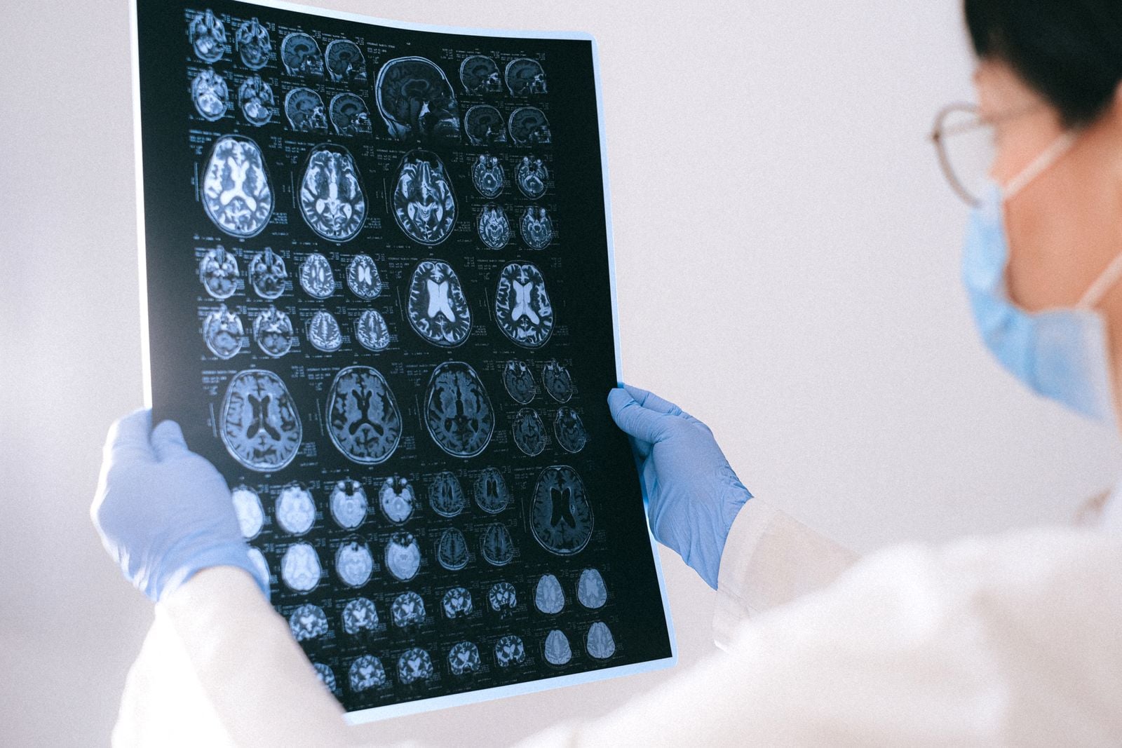 PET scan brain