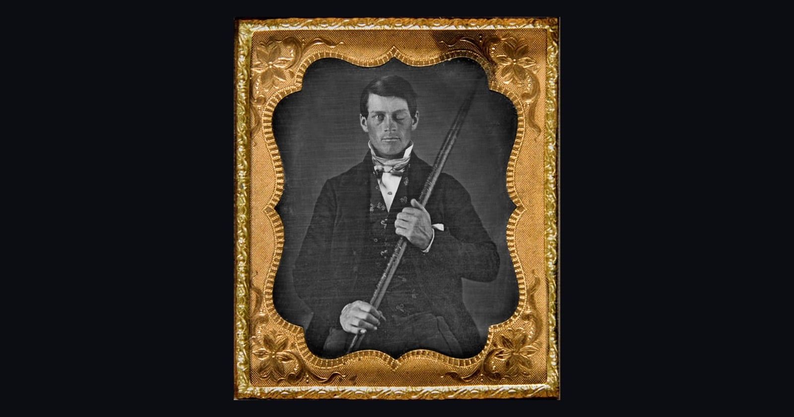 In 1848 an explosion drove a three-foot-seven iron bar clean through the skull of railway foreman Phineas Gage, who stayed conscious, spoke within minutes, and lived nearly twelve more years