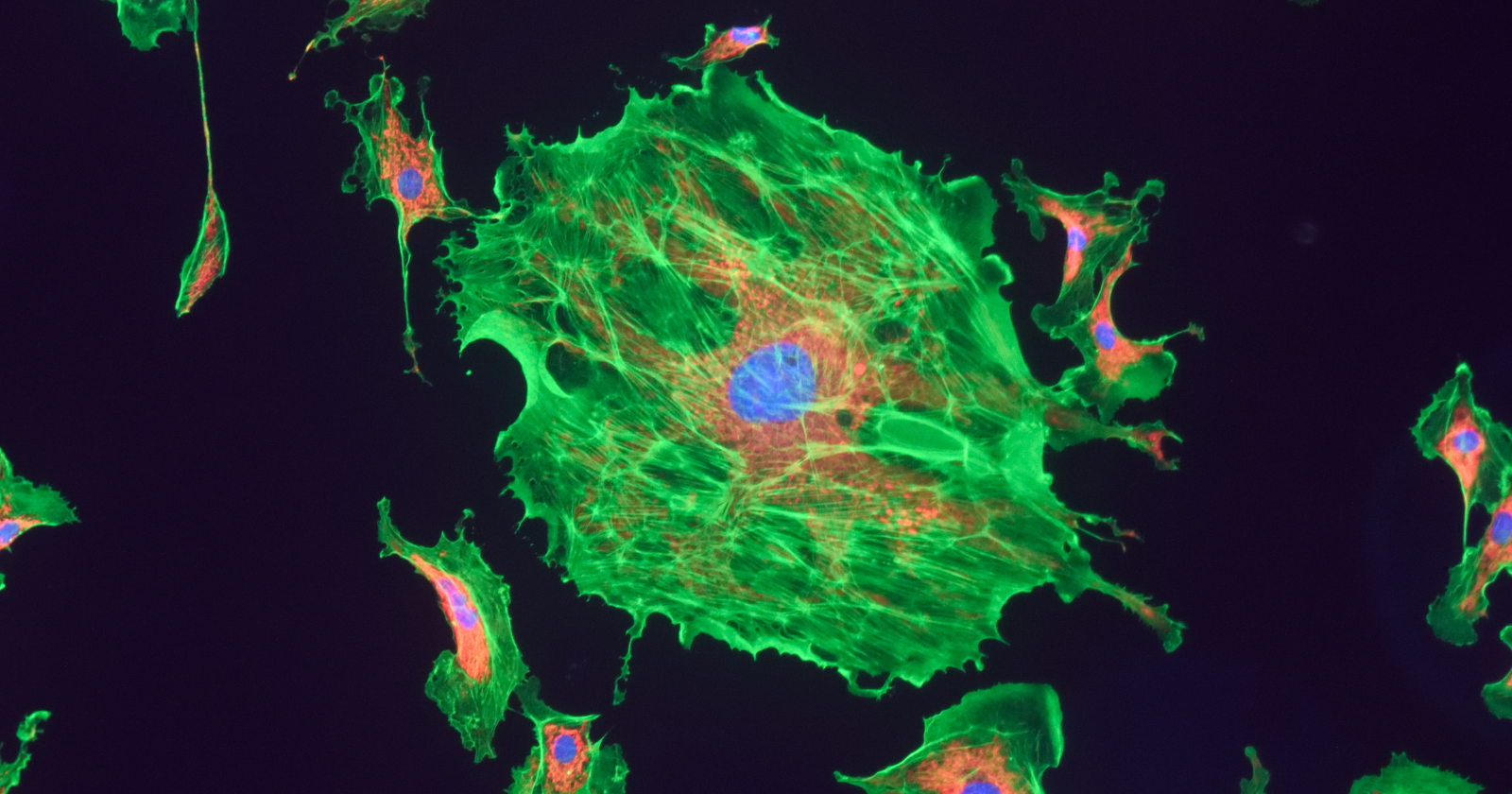 A damaged mitochondrion is worse than useless — it leaks and drags down the entire cell around it, like an engine slowly clogging on its own exhaust, until a recycling crew dismantles it