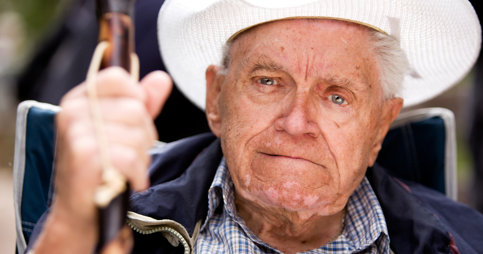 Dermatologists have long documented that the expressions worn most often across a lifetime eventually stop leaving the face and start staying — thousands of repetitions of the same smile, frown, or squint pulling the same muscles until the skin above them slowly loses the ability to return to neutral