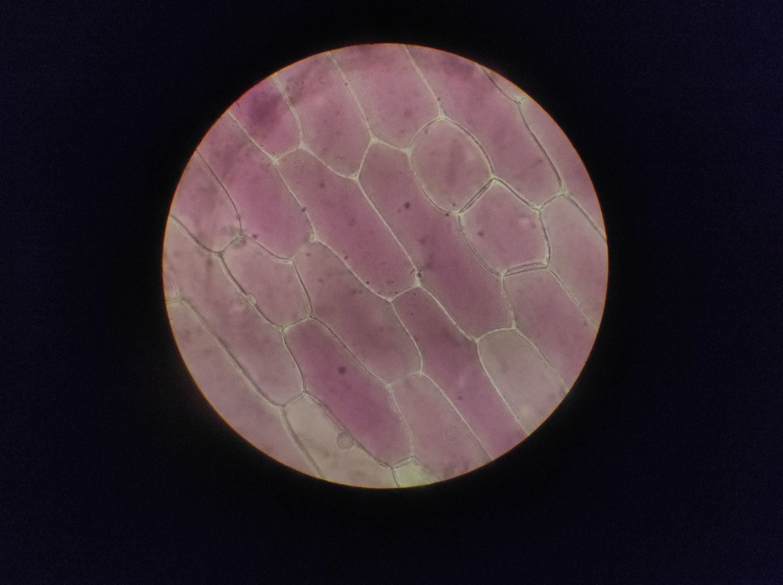 Every time one of your cells divides, the protective caps on its chromosomes shorten a little, and once they get critically short the cell either falls asleep p