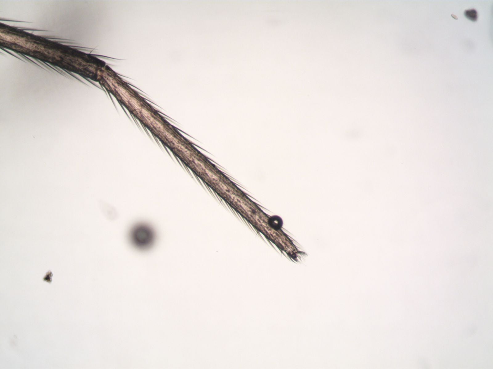 henneguya salminicola microscope