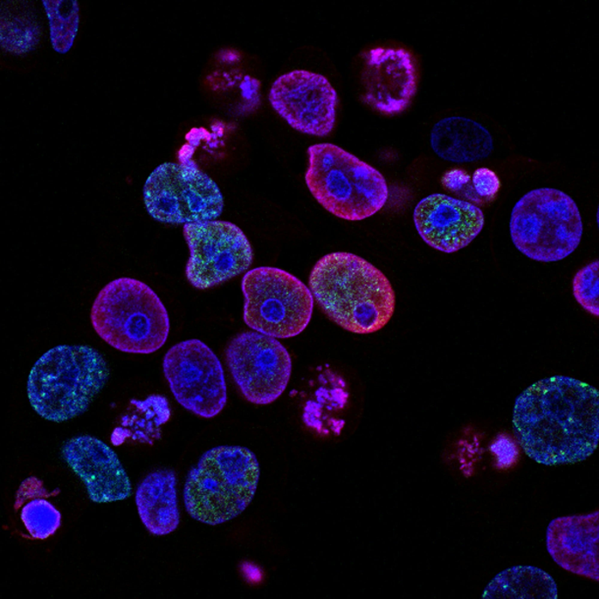 Scottish researchers named Caledochytrium aldermaii, a microbe whose offspring grow inside the mother — sometimes nested generations deep — until the outer cell bursts open